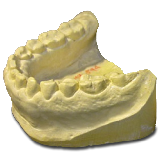 VisiJet® M3 StonePlast